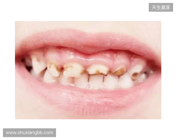 韦林顿确诊上唇部贯通伤；11、21牙半脱位；上颌前牙区牙槽骨骨折